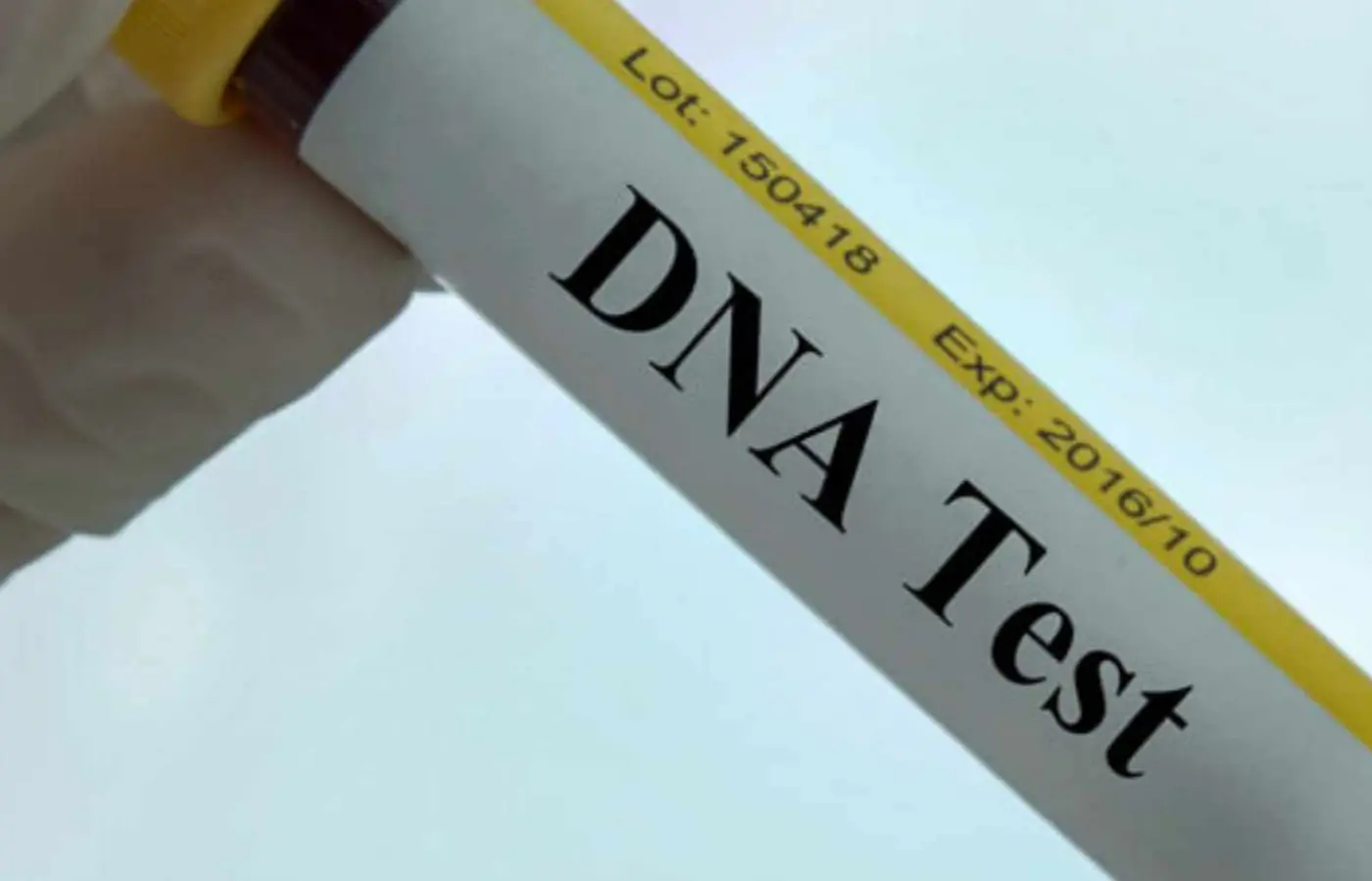 DNA Test